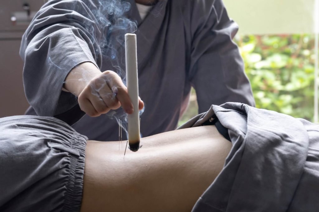 moxibustion